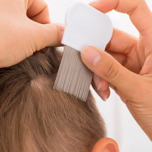Treating Lice in Children